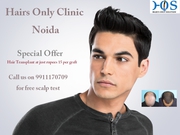 Hair Loss Treatment in Noida- At just rupees 15 per graft Contact HOS