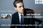 Low Cost Hair Loss Treatment in Noida-At just rupees 15 per Graft