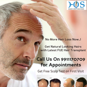 Best Hair Loss Treatment in Noida from HOS-9911170709