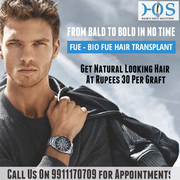 Get Hair Transplant Done from Hairs Only Solution (HOS) in Noida