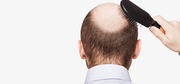 Hair Only Solutions Well-known for Hair Loss Treatment Noida, Sec-19