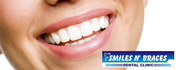 Implant in Lucknow | Braces in Lucknow - Orthodontistinlucknow