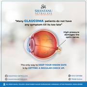 Glaucoma Treatment at eye care Centre in Varanasi