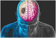 Treatment for Clot in Brain,  Brain Hemorrhage Treatment in Meerut